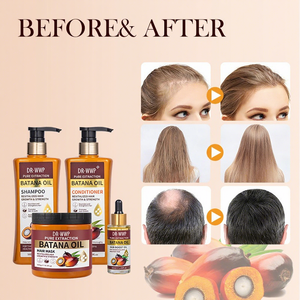 Ensemble de soins capillaires à l'huile de Batana, hydratant, nourrissant, réparateur, shampooing anti-pelliculaire pour des cheveux lisses - Product Image 2