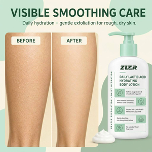 Loción Corporal con Ácido Láctico 12% AHA, Exfoliante, Suavizante e Hidratante para Piel Seca, Áspera y con Protuberancias, Tratamiento para la Queratosis Pilaris (KP) - Product Image 5