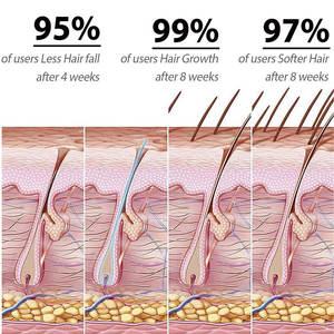 Marca Privada, Sérum Capilar 100% Natural y Orgánico, Hidratante, Reparador del Cabello Dañado, Nutritivo para el Cuero Cabelludo, Elixir para el Cuidado del Cabello, Anticaída, OEM - Product Image 4