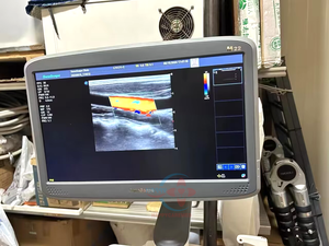 Mesin <span class=keywords><strong>Ultrasound</strong></span> Doppler Bekas Sonoscape M22 Instrumen <span class=keywords><strong>Ultrasound</strong></span> Medis Sistem <span class=keywords><strong>Ultrasound</strong></span> Harga - Product Image 6