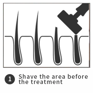 New product ideas 2019 ipl laser permanent hair removal with CE  approval