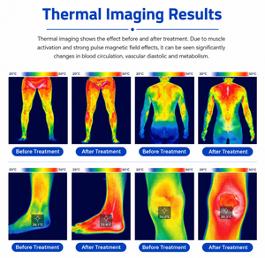 Equipo de Magnetoterapia EMTT de Alta Intensidad para Alivio del Dolor, Dispositivo de Terapia Magnética PEMF PRO para Humanos y Caballos - Product Image 5