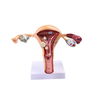 Modelo de Útero Femenino para Patología, Anatomía Médica, para Médicos y Estudiantes