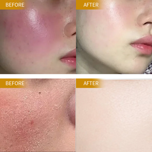 Mascarilla Facial Nutritiva con Aceites Vegetales Naturales, Mascarilla Facial Calmante e Hidratante, Cuidado Suave y Calmante para Aliviar la Piel Seca e Irritada - Product Image 4