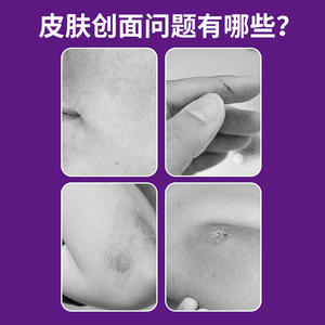 Gel Reparador con Hialuronato de Sodio Sunflower Medical 20g Para Piel Sensible, Cuidado Posterior al Láser - Product Image 5