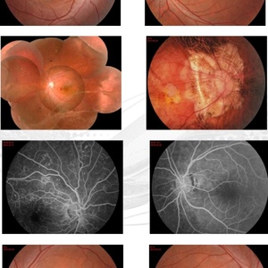 Caméra de fond d'œil numérique professionnelle haute résolution pour examen physique YDC10 - Product Image 6