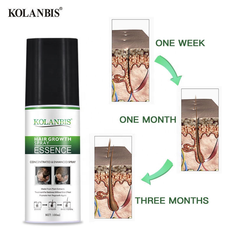 KOLANBIS, оптовая продажа, масло для восстановления роста волос при облысении, Лучший спрей для быстрого роста волос, лечение выпадения волос