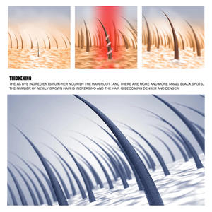 EELHOE <span class=keywords><strong>Spray</strong></span> épaississant pour les <span class=keywords><strong>cheveux</strong></span> <span class=keywords><strong>Racines</strong></span> nourrissantes Prévenir la perte de <span class=keywords><strong>cheveux</strong></span> <span class=keywords><strong>Spray</strong></span> pour la croissance des <span class=keywords><strong>cheveux</strong></span> au gingembre - Product Image 5