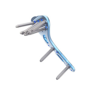 Instrumentos Médicos, Kit Quirúrgico Óseo, Implantes Ortopédicos de Alta Calidad, Implantes Quirúrgicos Ortopédicos para Columna Vertebral - Product Image 2