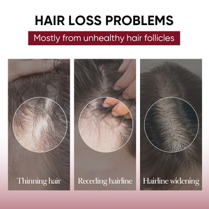 แชมพูและครีมนวดผมที่ช่วยให้ผมร่วงปราศจากซัลเฟตสินค้าตรา OEM - Product Image 4