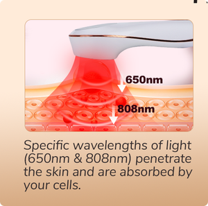 Équipement de physiothérapie, appareil de thérapie <span class=keywords><strong>laser</strong></span>, <span class=keywords><strong>laser</strong></span> pour soulager la douleur, <span class=keywords><strong>acupuncture</strong></span> et moxibustion, physiothérapie pour animaux de compagnie de grade 3B - Product Image 3