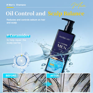 แชมพูควบคุมความมันสำหรับผู้ชาย ทำความสะอาดหนังศีรษะ ขจัดรังแค บรรเทาอาการคัน แชมพูขจัดรังแค - Product Image 3