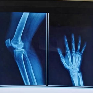 Blue Inkjet Medical Trocken film <span class=keywords><strong>PET</strong></span> Glossy Water proof Rigid für Epson für OKI Fuji Xerox X Ray CT CR DR 210 Mikron - Product Image 3