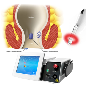 Sistema de Láser de Diodo para Endoscopia Anal para Hemorroidectomía 980nm 1470nm Equipo de Cirugía Mínimamente Invasiva Hemorroides Fístula - Product Image 2