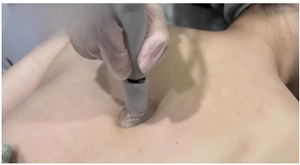 Appareil de soin du <span class=keywords><strong>visage</strong></span> 2-en-1 multifonctionnel à microdermabrasion cristalline et électroporation, équipement OEM pour l'importation - Product Image 4