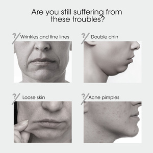 Dispositivo V-Face para Pliegues Nasolabiales, Masajeador Facial Inteligente, Moldeador, Microcorriente, Adelgazante de Mentón, Herramienta Mágica de Belleza Facial - Product Image 3