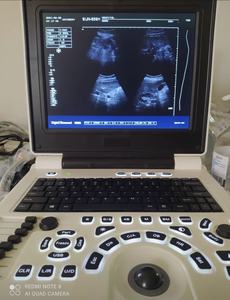 Prix des ultrasons numériques de diagnostic par ultrasons à ultrasons médicaux de poche B - Product Image 3