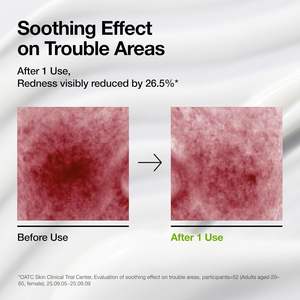 Anua - Crema Hidratante Calmante con Ácido Azelaico 3 y Cica, 100 ml, para Piel Propensa al Acné, Uso Diario Ligero - Product Image 4