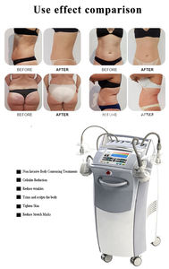 Gran Descuento en la Máquina Adelgazante Venus Legacy con Tecnología de Vacío para la Eliminación de Grasa Abdominal y Material ABS - Product Image 5