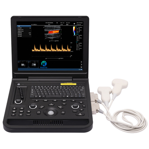 Escáner de Ultrasonido Doppler a Color para Detección del Latido Fetal en Clínicas, Económico y de Bajo Costo - Product Image 5