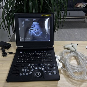 Échographe Doppler Couleur Portable pour Hôpital, Meilleur Prix, Appareil d'Échographie Humaine Portable CU20 - Product Image 4