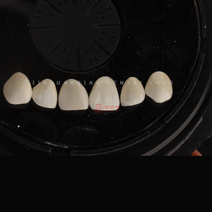 Carilla de cerámica de porcelana para dentaduras postizas de alta calidad, personalización privada para el cuidado <span class=keywords><strong>dental</strong></span>, recuperación oral - Product Image 1