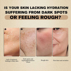 Crème <span class=keywords><strong>Visage</strong></span> au Riz Bio Naturel, Enrichie en Collagène, Acide Hyaluronique et Vitamine C, Hydratante, Anti-Âge, Végane, 50ml, Anti-Acné, Éclaircissante, Pour Tous Types de Peaux - Product Image 4