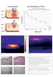 Nouvel appareil de remodelage corporel et de lifting facial Onda Pro Coolwave 2,45 GHz – Équipement Onda Pro Coolwave pour remodelage corporel et lifting facial - Product Image 3