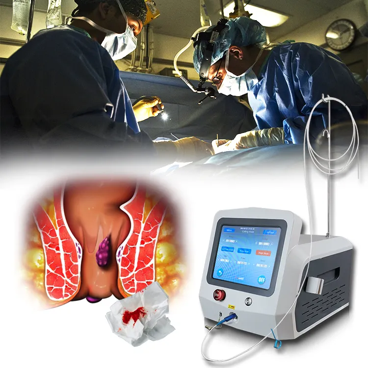 980nm Laser Ablation Anorectal Surgery Equipments Proctology Laser 1470nm Hemorrhoids Treatment Proctology Laser