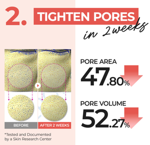Pads tonifiants No4 Pore Zero à l'extrait d'œuf, exfoliants et minimisant les pores, pour une peau lisse, pads de peeling doux - Product Image 4