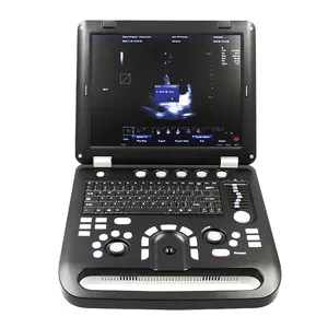 Contec CMS1700C Draagbare Ultrasound Machine Kleur Doppler Medische Echografie Instrumenten