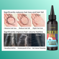 Oalen Vente en Gros Huile Capillaire Nourrissante Naturelle et Pure pour Cuir Chevelu Sec, Huile de Croissance Rapide Chebe