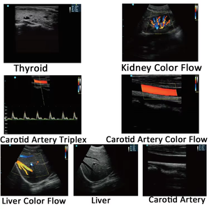 Draagbare zwart-witte echografiemachine voor mens en dier, digitaal <span class=keywords><strong>laptop</strong></span> B-echoscopie apparaat voor zwangerschapsdiagnostiek - Product Image 4