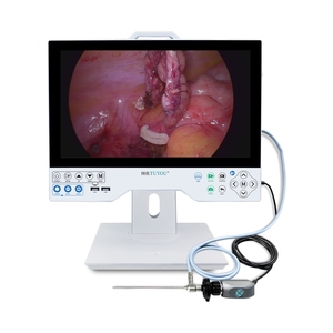 Sistema de cámara de endoscopia rígida Full HD con monitor y grabación todo en uno de 15,6 "para cirugía o examen de otorrinolaringología - Product Image 1