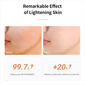 Sérum LANBENA Cosmetics Niacinamide Acetyl Hexapeptide-8 Glazen, flacon en verre, vitamine E, emballage vert, acide hyaluronique, sérum CC - Product Image 5