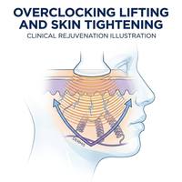 Appareil professionnel 14-en-1 pour soins liquides hydro-faciaux, peeling aquatique, rajeunissement cutané, soins du visage, du cuir chevelu et du corps, usage professionnel en salon