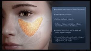 Máquina de Rejuvenecimiento Facial 12D de Nuevo Diseño, Máquina Profesional de Lifting y Antienvejecimiento para Rostro y Cuerpo - Product Image 6