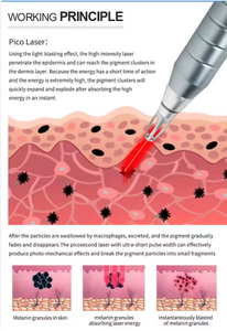 Equipo de Belleza Láser Ice Platinum, Depilación Láser de Diodo y Eliminación de Tatuajes con Láser Pico 2 en 1 para Uso en Salón, OEM ODM - Product Image 6