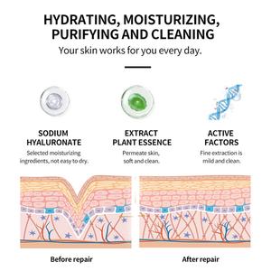 Tónico Facial Hidratante e Iluminador con Vitamina C Qingying de 250 ml para el Cuidado de la Piel, Venta al por Mayor - Product Image 3