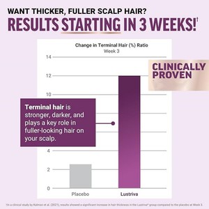 Gomitas de Biotina para el Crecimiento del Cabello, 60 Unidades, Gran Venta |   Vitaminas para el Cabello, Fortalecimiento y Grosor |   Stock de Fábrica - Product Image 3