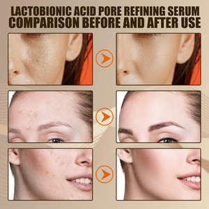 Sérum à l'acide lactique EELHOE 30 ml, soin du visage anti-rides, raffermissant, doux, lissant, rafraîchissant, hydratant, usage quotidien - Product Image 4