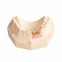 Pont dentaire en zircone de marque Ecolab personnalisé pour les laboratoires dentaires et cliniques, fabriqué au Guangdong, durable, longue durée, ajustement complet de la bouche