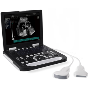Full <span class=keywords><strong>Digital</strong></span> <span class=keywords><strong>Laptop</strong></span> <span class=keywords><strong>Doppler</strong></span> Schwarz-Weiß-Ultraschall gerät Tragbares Medizin produkt Physiotherapie Ultraschall - Product Image 1
