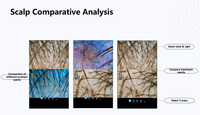 Nouveau Système de Diagnostic Peau et Cheveux 2-en-1 2026 – Analyseur Cutané avec Machine d'Analyse du Cuir Chevelu et des Cheveux