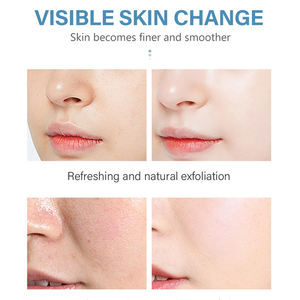 סרום טיפוח לעור הפנים 30 מ\\\"ל סיטונאי, לטיפול בנקבוביות, פילינג לעור, תמיסת קולגן עם 5% חומצה לקטית - Product Image 6