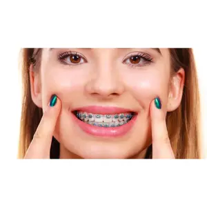Diş güzellik ekipmanları ortodontik moda sahte sahte diş telleri