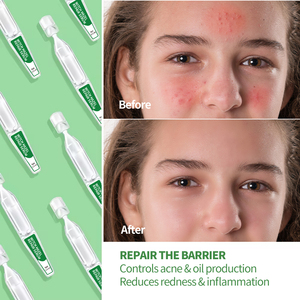 Suero Hidratante Antienvejecimiento Vegano Orgánico <span class=keywords><strong>de</strong></span> Marca Privada Personalizada OEM, Sin Agua, con <span class=keywords><strong>Aloe</strong></span> <span class=keywords><strong>Vera</strong></span> <span class=keywords><strong>para</strong></span> Reparación y Blanqueamiento <span class=keywords><strong>de</strong></span> <span class=keywords><strong>la</strong></span> Piel del Rostro - Product Image 2