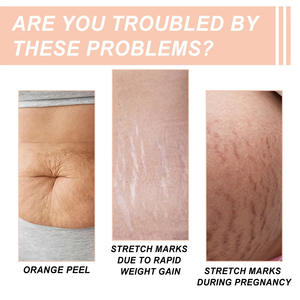 Crème Réparatrice Bio Naturelle aux Extraits de Bave d'Escargot OEM/ODM contre les Vergetures, pour la Maison, la Femme Enceinte et Post-partum - Product Image 2