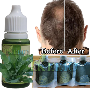 Bubuk ekstrak Purslane pertumbuhan rambut bubuk ekstrak portuaca <span class=keywords><strong>Oleracea</strong></span> alami - Product Image 2