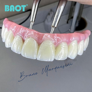 Kit Professionale PFZ per Riempimento Dentale, Set di Materiali in Porcellana, Polvere Ceramica Dentale, Kit Master per Odontoiatri - Product Image 3